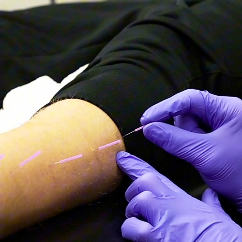 V_AtlantaRehab_VideoStill_6
